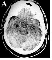 A is the psycho, PLoS image
